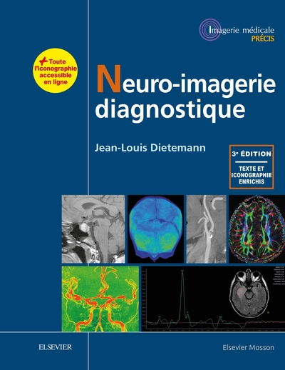 Neuro-imagerie diagnostique