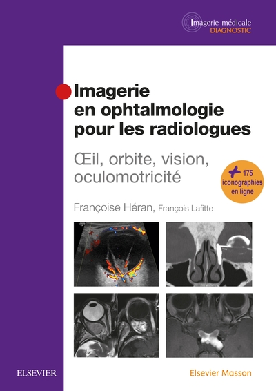 Imagerie En Ophtalmologie Pour Les Radiologues, Oeil, Orbite, Vision, Oculomotricité - Françoise Héran, François Lafitte