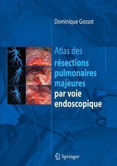 Atlas des résections pulmonaires majeures par voie endoscopique - Dominique Gossot