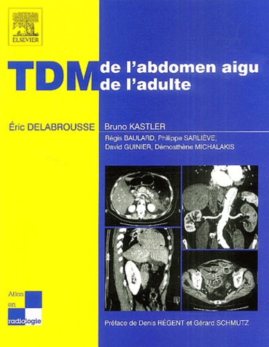 TDM de l'abdomen aigu de l'adulte